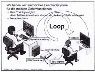 Neurofeedback